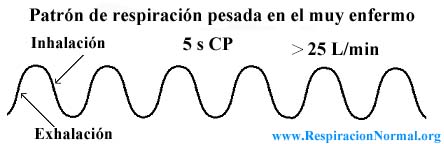 Patrón de respiración pesada en enfermo