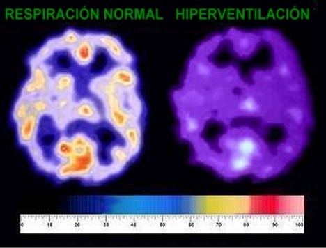 Oxígeno en el cerebro