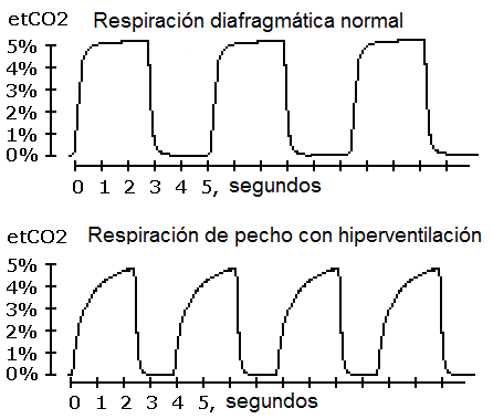 etco2-grafico-capnografia-capnograma