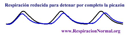 Gráfico de detener picazón por completo