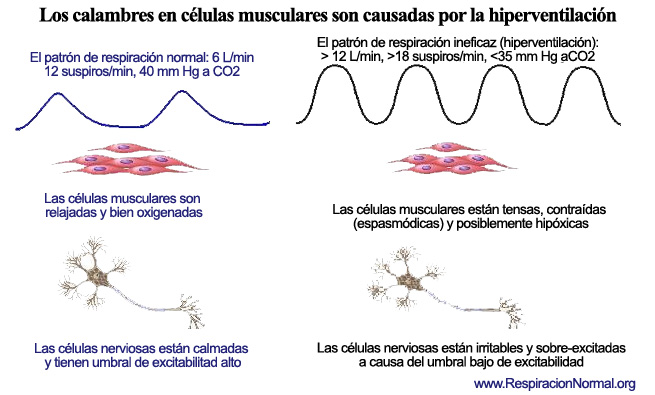 La hiperventilación causa calambres en las células musculares