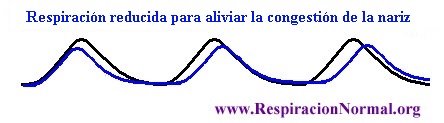 Respiración reducida para aliviar congestión