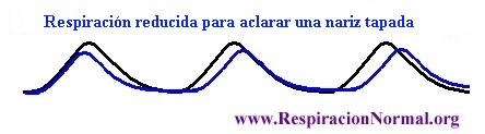 Respiracion reducida destapar nariz