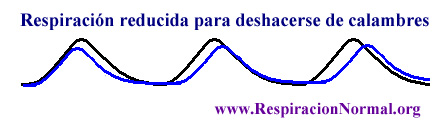 Como Deshacerse de Calambres