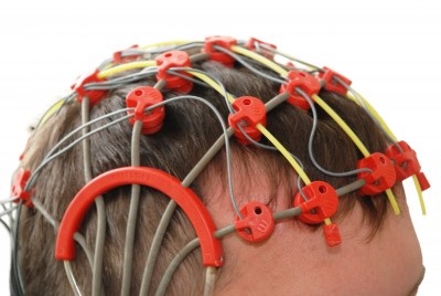 examinacion convulsiones por epilepsia