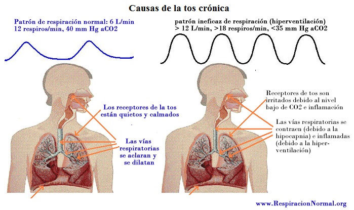 Causas de tos crónica