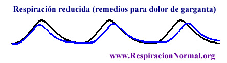 Remedios para dolor de garganta